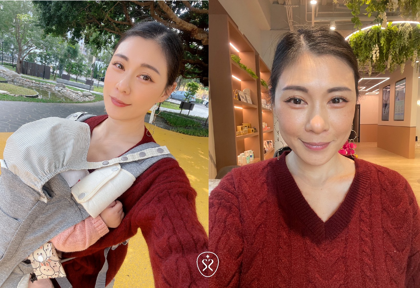 玩美電波效果真的很好，但多少還是會因為每個人的體質及術後的保養會有些許的差異唷